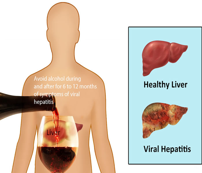 Hepatitis B Causes